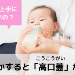 【体験談】赤ちゃんが高口蓋になったときの対処法